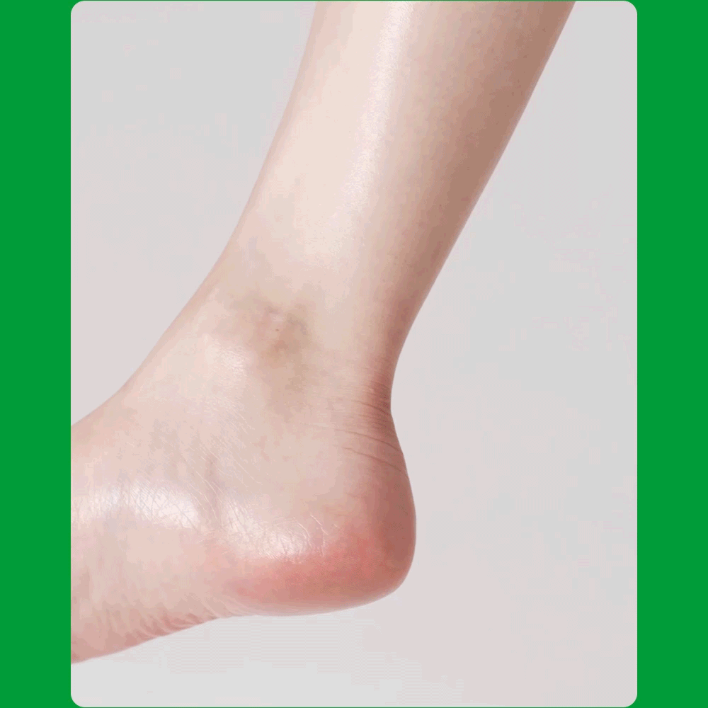 Heel Peeling Mask | 後腳跟去角質足膜